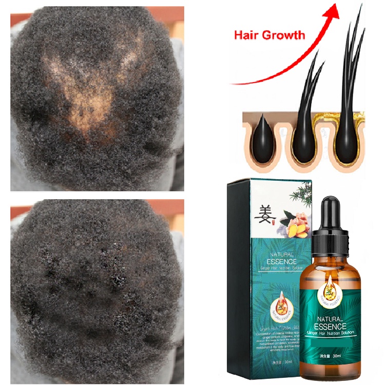 Hair tonic hair care growth set hair growth oil Ginger Conditioner Anti hair  loss Tonik rambut tonik subur rambut生发水防脱发 | Shopee Malaysia