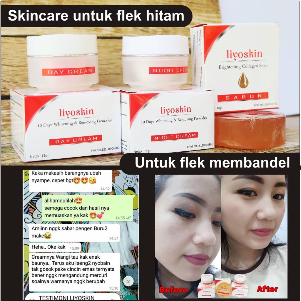 HITAM PRIA Dark Spots Remover cream Aged 40 In Apotic For Men And Women Safe BPOM Superior Spots Remove The Face Of Chocolate melasma kokoloteun