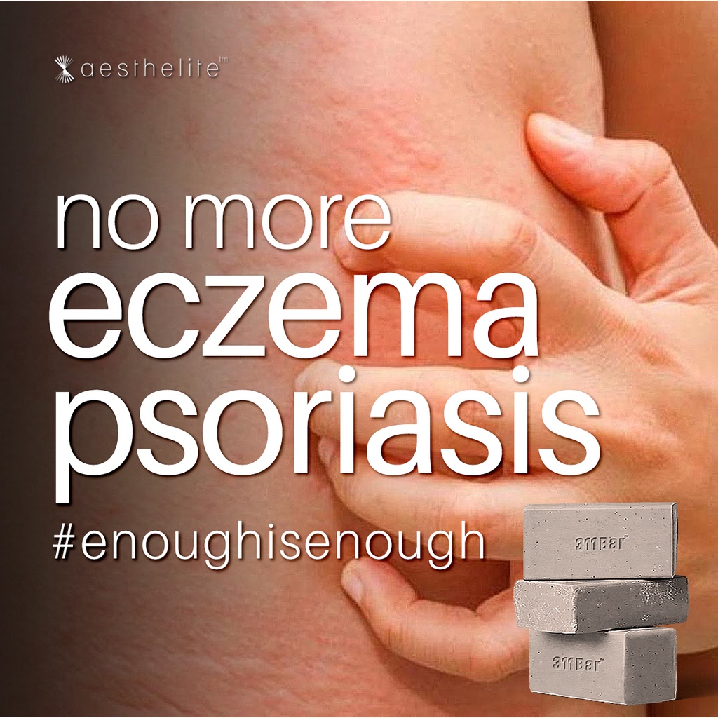 311BAR Eczema Psoriasis Soap [100g] | Shopee Malaysia