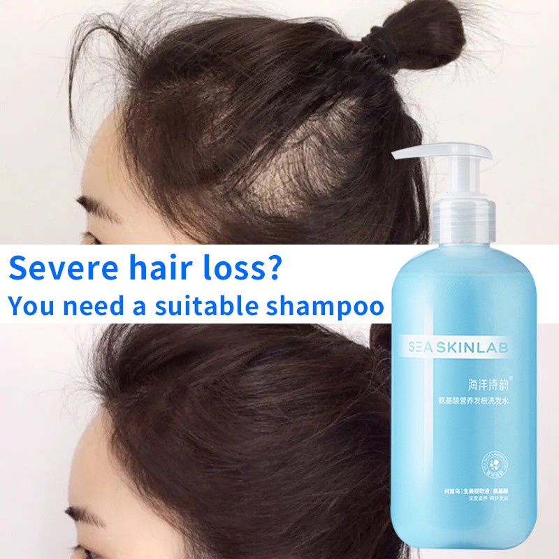 In Stock】 【Ready Stock】Amino acid hair loss shampoo, hair loss/oil  control/Nourish hair/hair care/anti hair loss shampo | Shopee Malaysia
