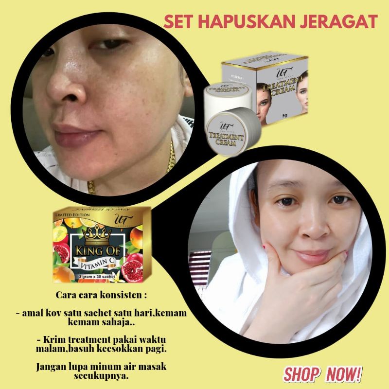 Set Rawat Kulit Muka Dan Badan Putih Gebu Seluruh Badan