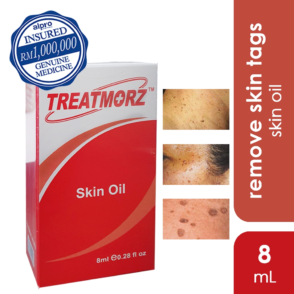 Treatmorz Skin Oil for Tags Removal (8ml) Shopee Malaysia