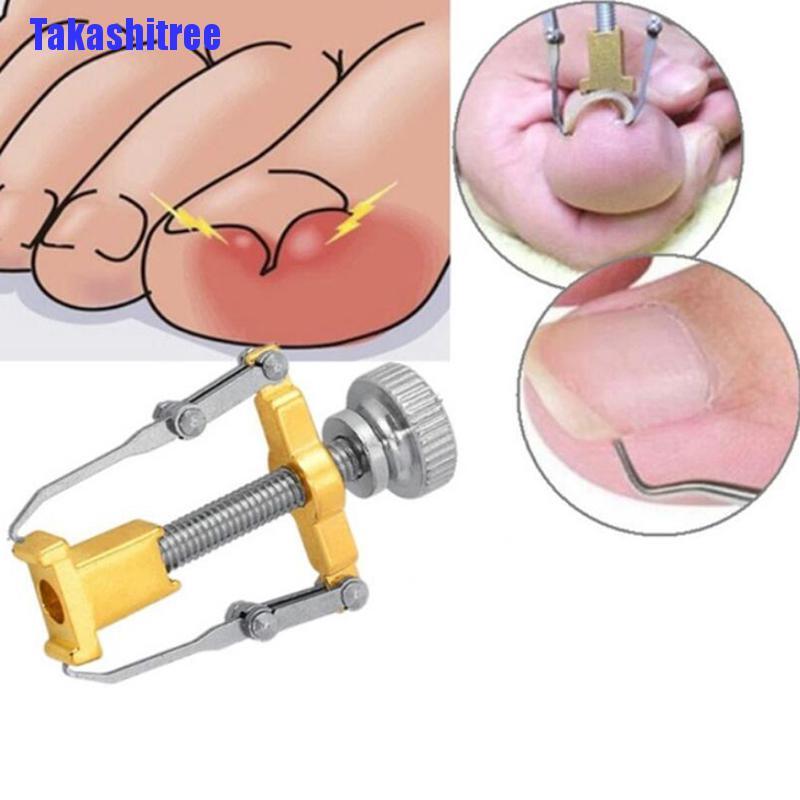 Craft Build Takashitree Ingrown Toenail Toe Fixer Recover Correction Device Pedicure Foot Nail Care Tool Repair Duty - Image 4