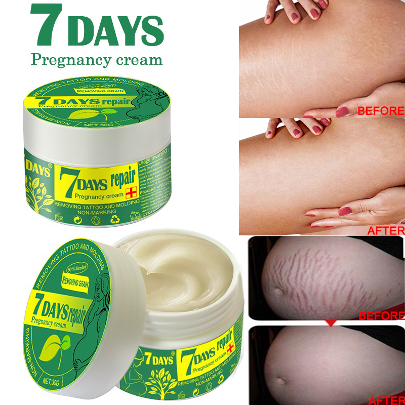 scar removal cream for stretch marks