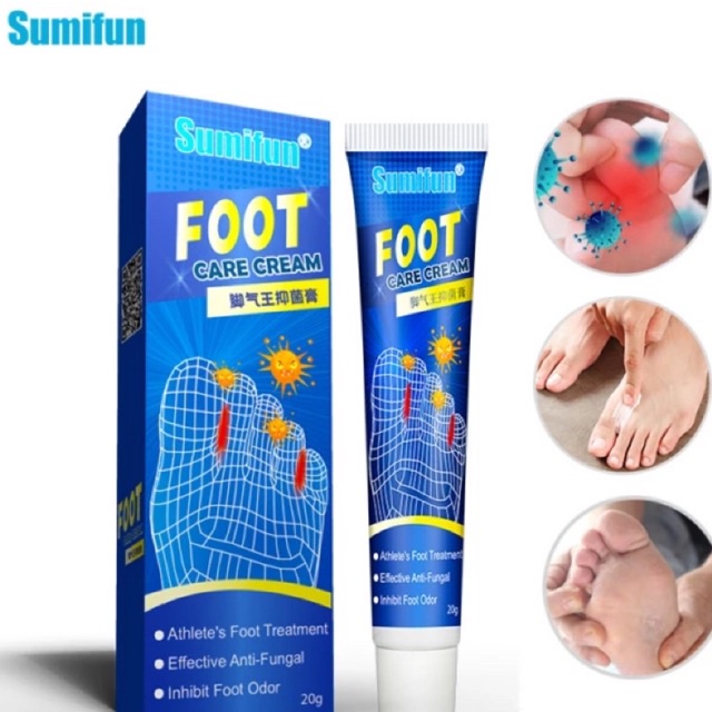 Ubat kaki mengelupas gatal Foot fungus antibacterial Kaki makan air ...