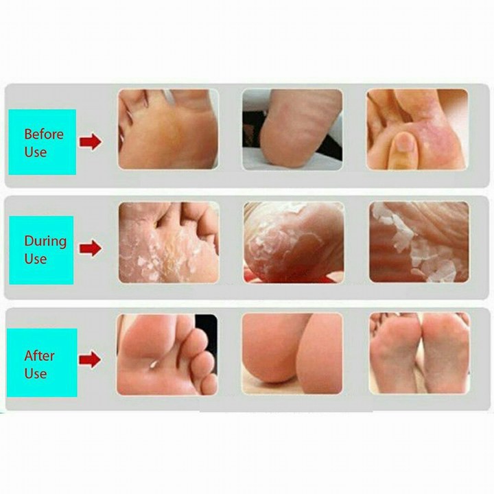 exfoliate dead skin