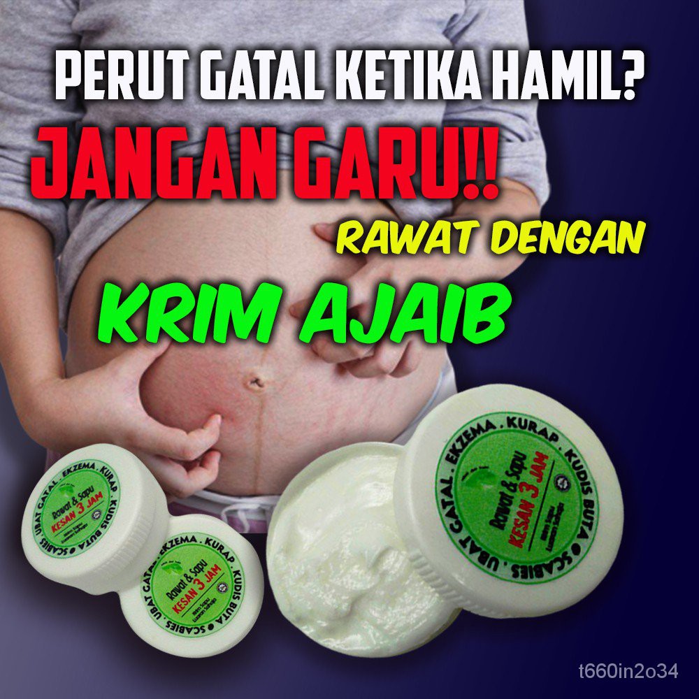 Krim Ubat Gatal Badang Kudis Buta Ruam Kulit Dan Kurap Shopee Malaysia