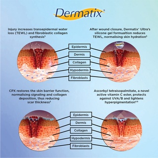 Original Dermatix Ultra G Dermatix Scar Care Gel Dermatik Scar Reduction Cream Dermatic Acne