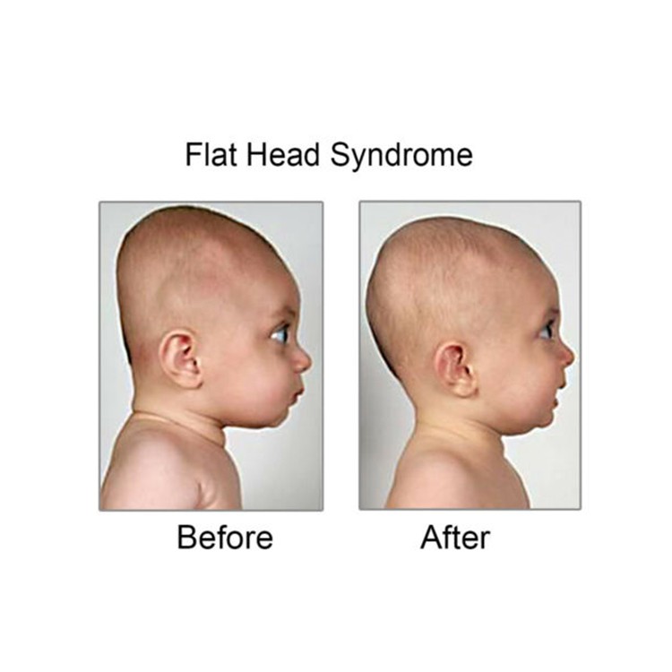 Newborn Baby Head Shaping Pillow Preventing Flat Head Syndrome