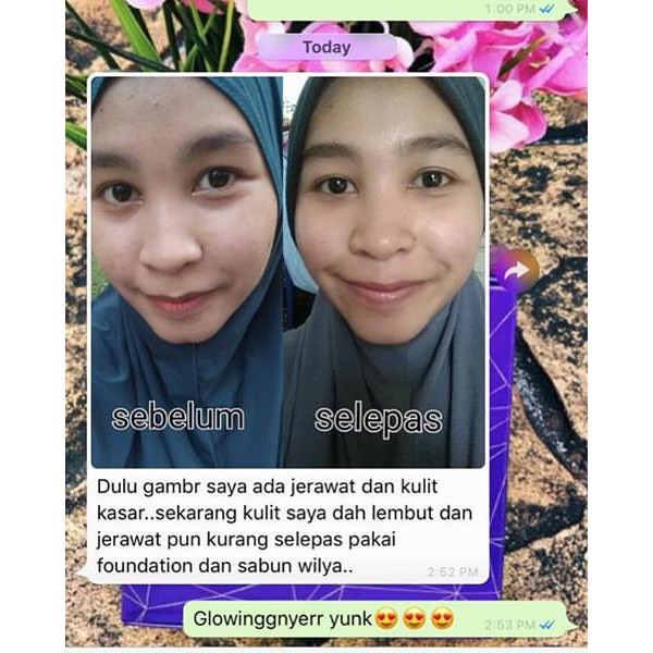 Best Seller Wilya Whitening Soap 100 Original Kulit Kembali Cerah Shopee Malaysia