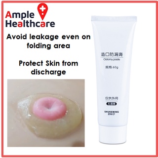 Ostomy Stoma Skin Barrier Paste 60g Prevent Leakage | Shopee Malaysia