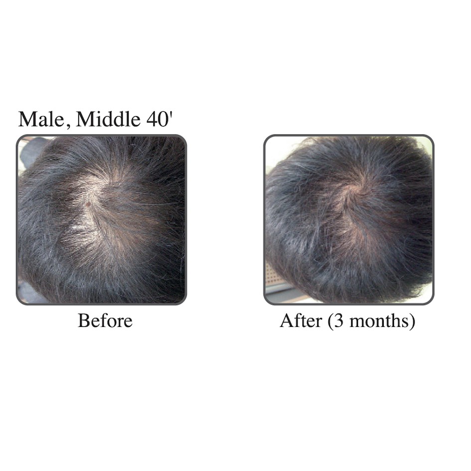 SKINLABS Hair Dr Follicle solution serum 100ml Prevent Hair loss Solution  Strengthen hair shaft hair growth healthy | Shopee Malaysia