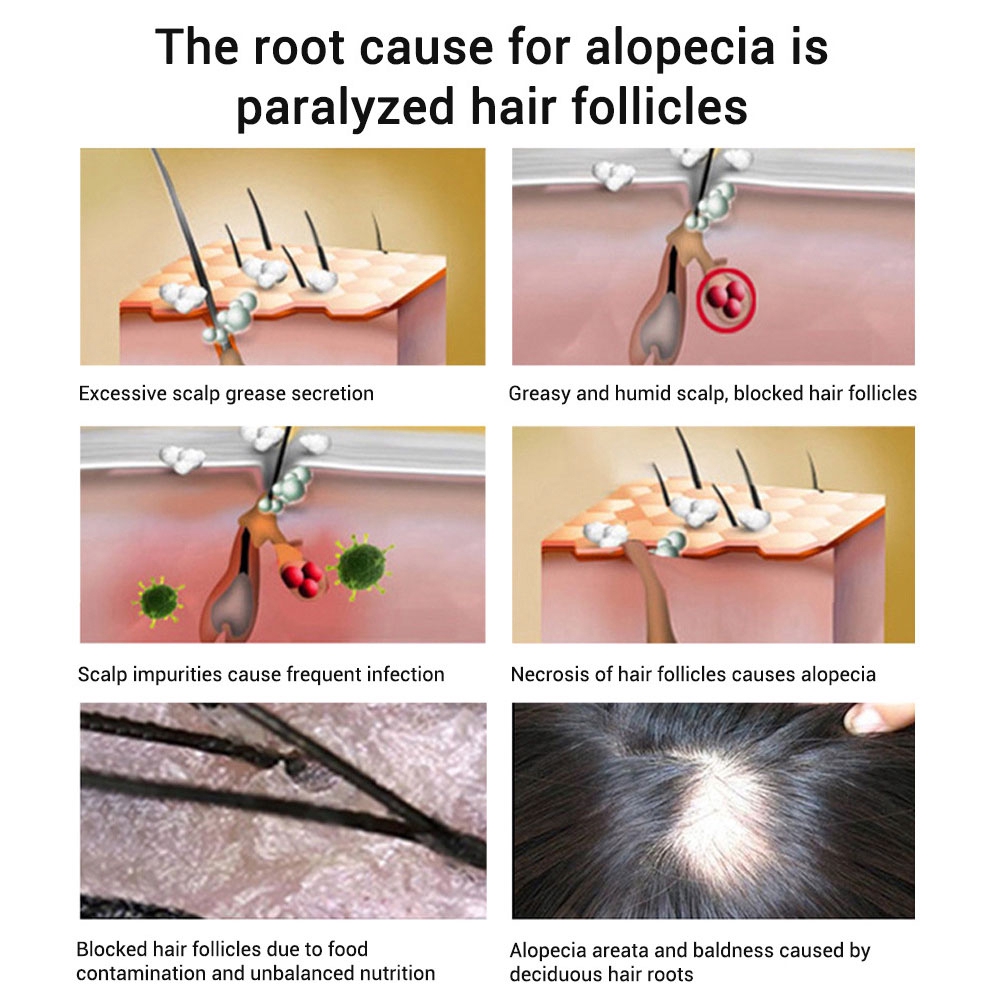 Natural Hair Treatment Hair Lanbena Health Growth Loss Ginseng