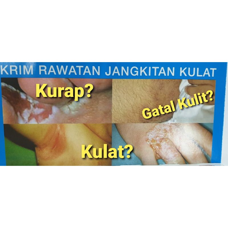 Ubat Krim Kurap Kulat Makan Air Gatal Celah Paha Kangkang Shopee Malaysia