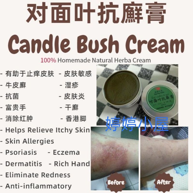Buy Krim Gelenggang 對面葉药膏 Rashes Neem Oil 富贵手 Ekzema Eczema Krim Kurap 紫草膏comfrey Balm 左手香膏mexican Mint Seetracker Malaysia