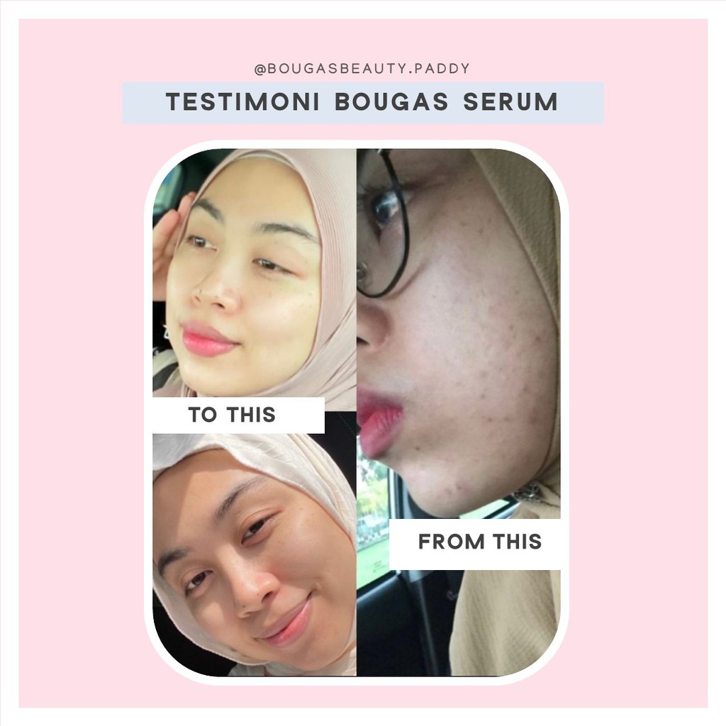 Buy Ready Stock Bougas Serum Bougas Beauty Advanced Serum 20ml Seetracker Malaysia
