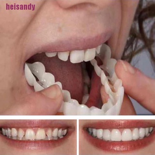 Veneer Whitesmile Orthodontic Dental Braces Specialist Kuala Lumpur