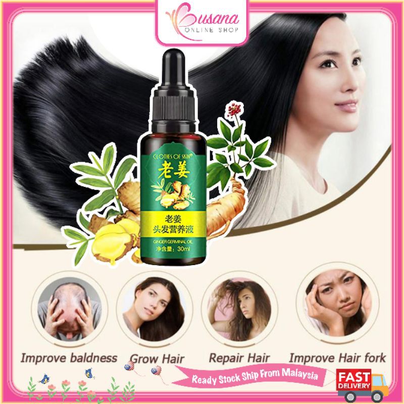 【Fast Delivery】Ginger Germinal Essential Oil Hair Growth Loss Treatment For Men & Women 30ml