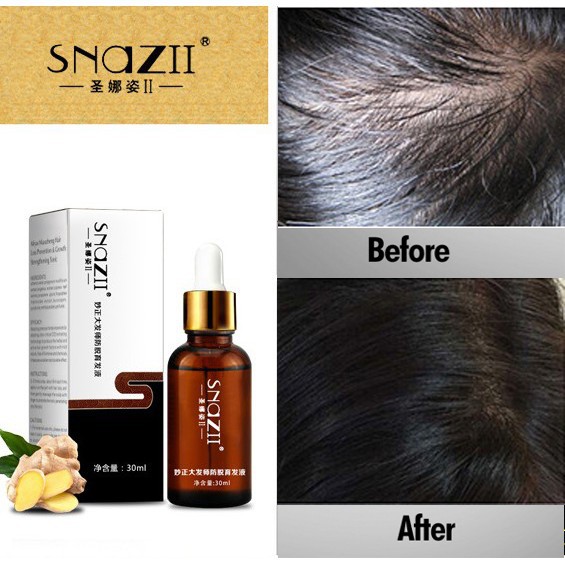 Ready Stock 100 Original Snazii Anti Hair Loss Hair Growth