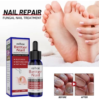 Eelhoe Nail Repair Essence Nail Care Hands and Feet Nail Repair Moisturizing Clean Nail Removal Repair Essence