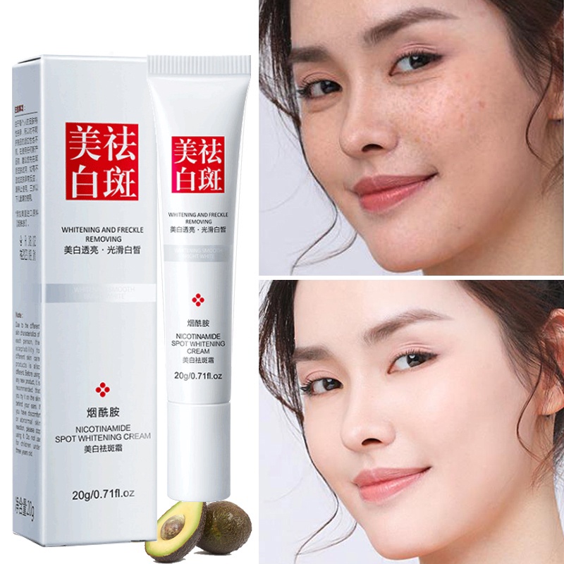 Whitening And Freckle-removing Cream 20g Moisturizing And Hydrating 