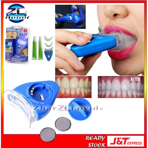 Teeth Whitening In WhiteLight Tooth | Alat Putih Gigi Bersih Jaga Kuning Karat Mulut Berbau Pantas Pendakap Putihkan