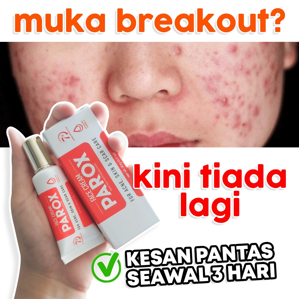 Ubat Parut Jerawat Cream Parox Ubat Parut Lulus Kkm Krim Parut Jerawat Berkesan Shopee Malaysia