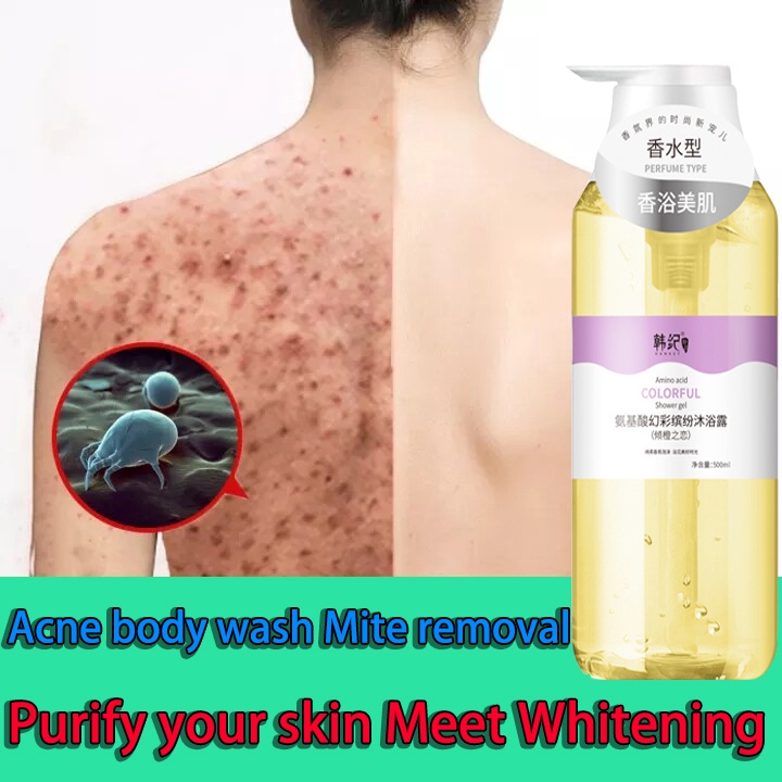 Eczema Treatmen Remove Acne Mites Shower Gel Anti Itch Whitening Body