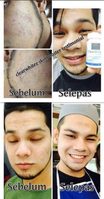 clear whitez skin booster