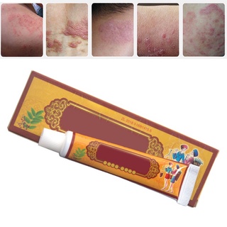 YWDH 1 Piece Treatment Dermatitis Eczema Hand Ringworm Antipruritic