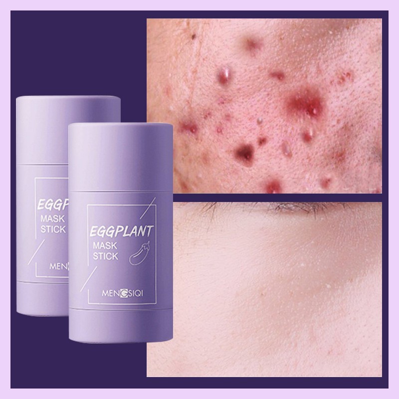 ♥NEW ARRIVAL♥ Eggplant Mask Stick Anti acne Delicate Pore Mask Balance