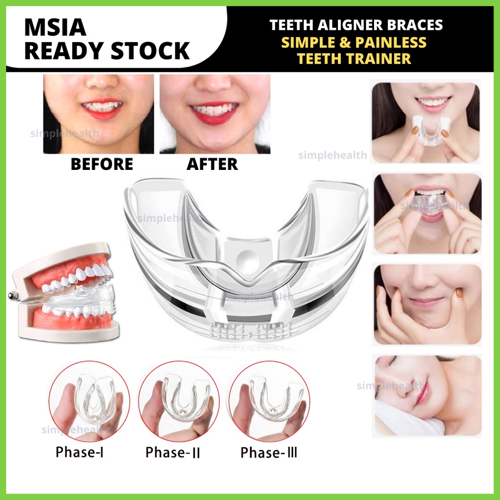 Braces Dental Pendakap Gigi Tooth Orthodontic Appliance Trainer Braces