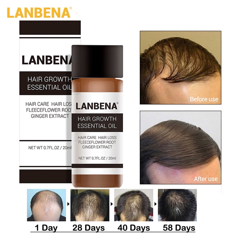 Lanbena Hair Growth Essence Liquid Treatment Preventing Hair Loss