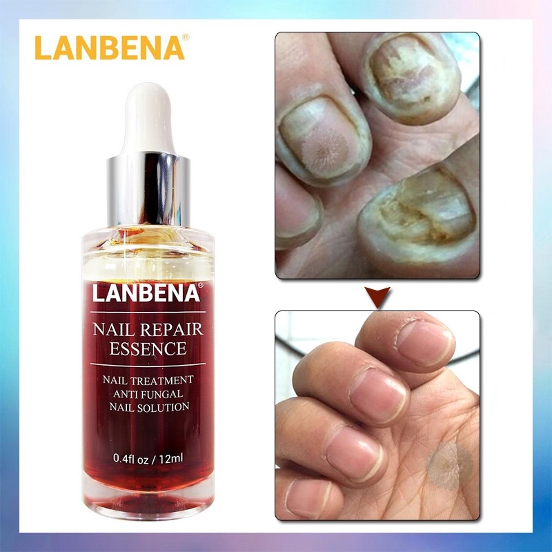 lanbena nail repair