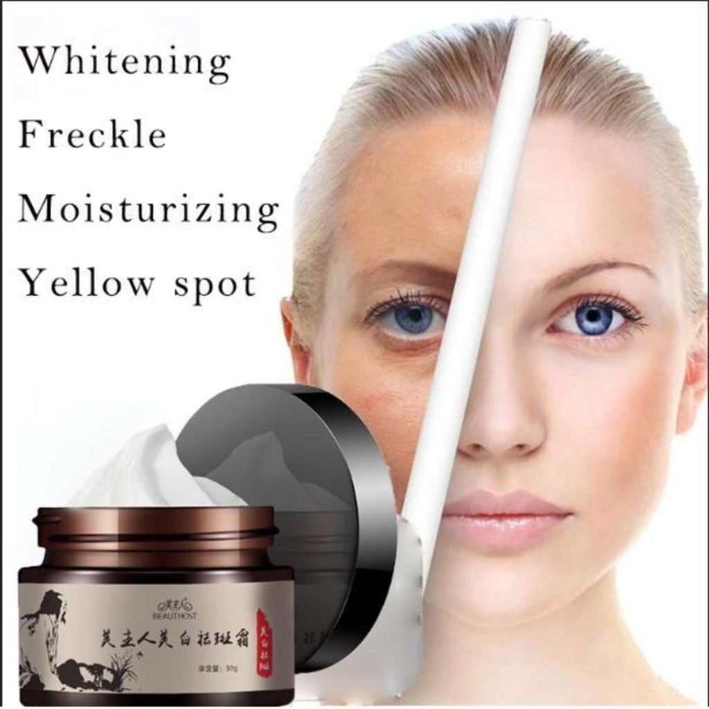 freckle lightening cream