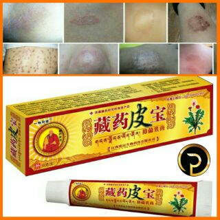 *Original*Psoriasis Treatment Ointment Herbal Eczema Cream 