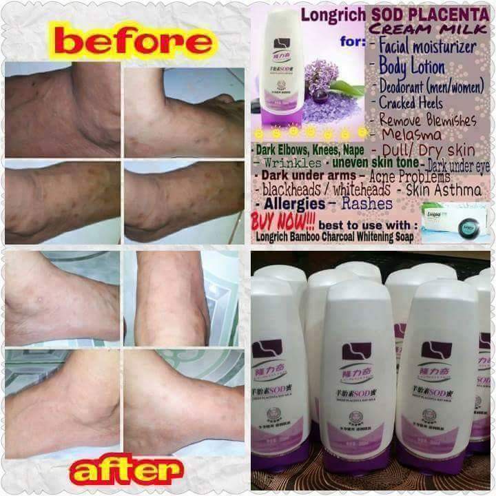 Longrich SOD Sheep Placenta SOD Milk Shopee Malaysia