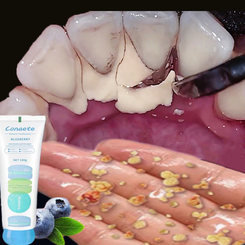 ubat gigi whitening Toothpaste kiwi ubat gigi plak gigi ukiwi whitening