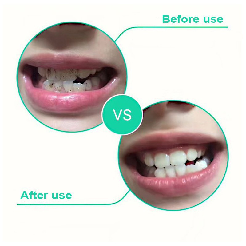 Buy ☀100% Original☀Quick Teeth WhiteningToothbrush Quick Teeth 