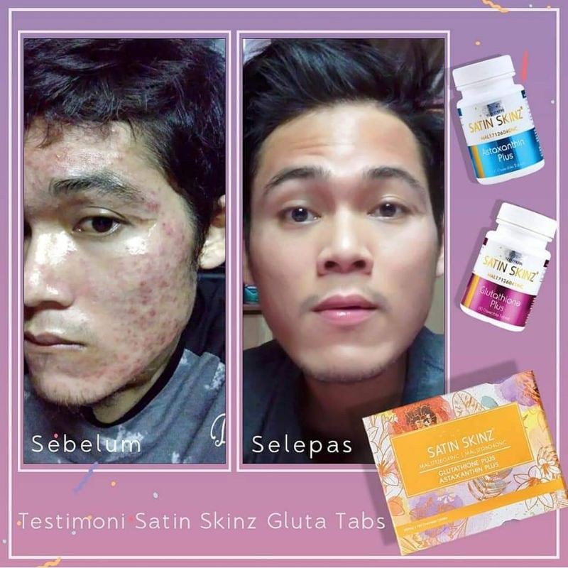 Satin Skinz 5x Flawless Pinkish And Glow Skin Shopee Malaysia