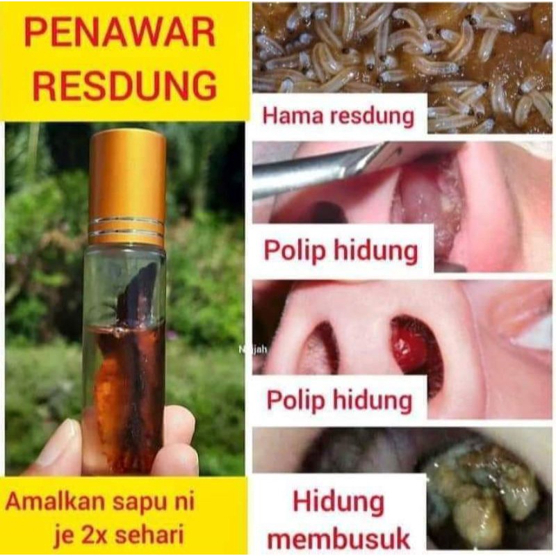 Buy Free Gift Resdung Hilang Tanpa Perlu Makan Ubat Roll On Resdung Hilang Seetracker Malaysia