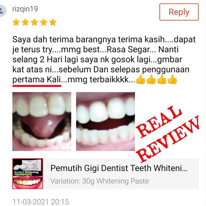 Pemutih Gigi Dentist Teeth Whitening Ubat Gigi yang Disyorkan oleh Doktor  Gigi Dental Clinic