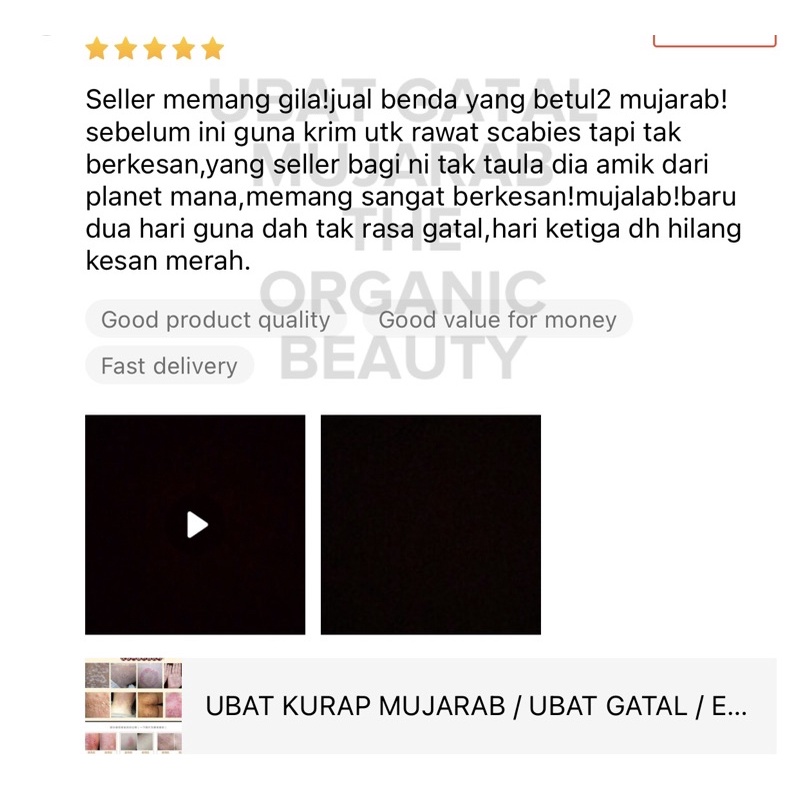 Ubat Kurap Ubat Gatal Mujarab Ubat Eczema Mujarab Ubat Gatal Herba Mujarab Shopee Malaysia