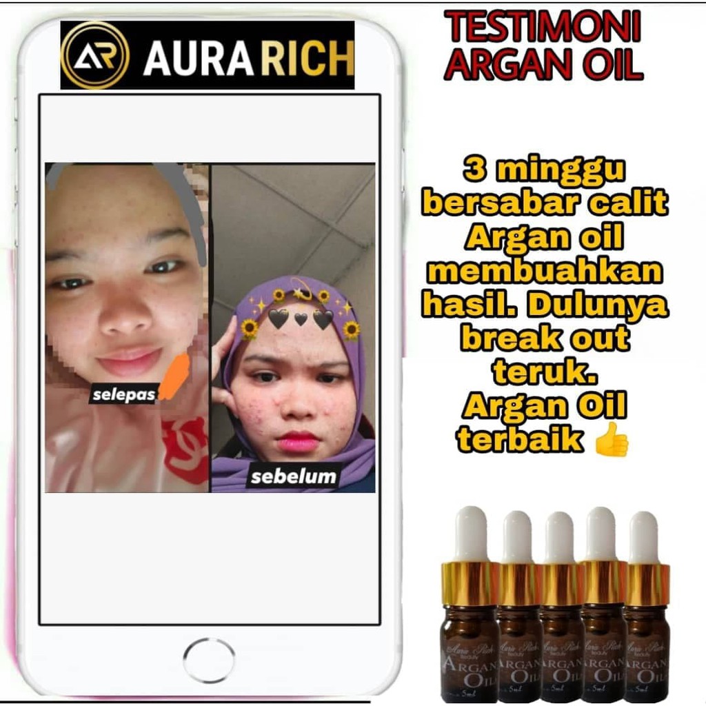 Buy Argan Oil Aura Rich Beauty Minyak Toner Serum Cerah Kulit Muka Wajah Hilang Pudar Parut Jerawat Kedutan Antioksidan Seetracker Malaysia