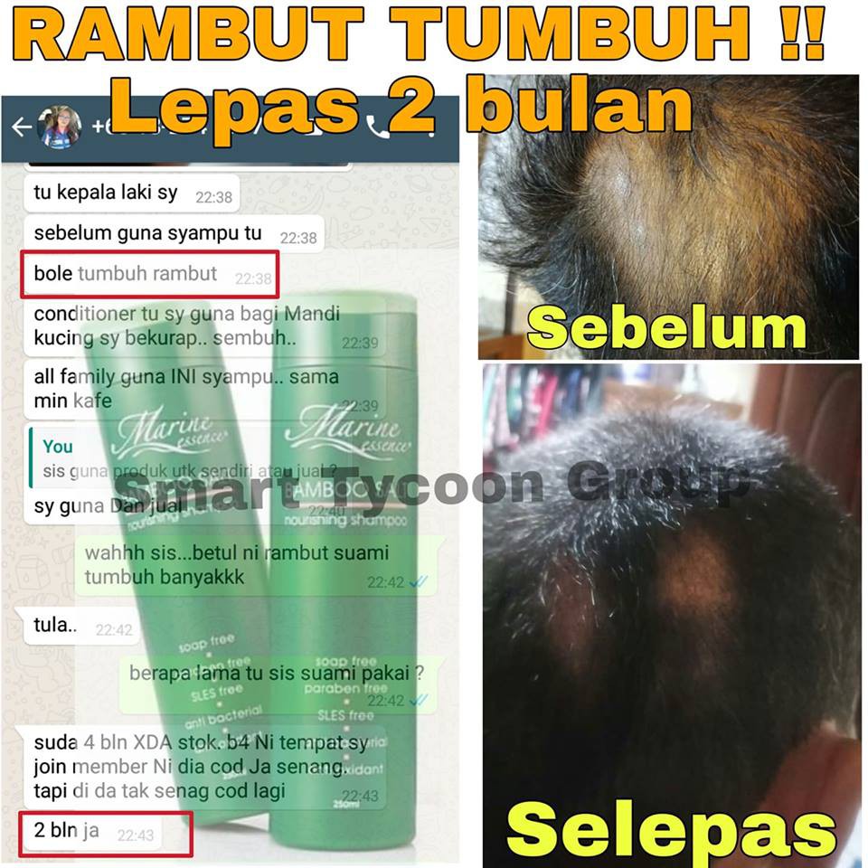 Lebatkan Rambut 100 Ori Me Shampoo Shopee Malaysia