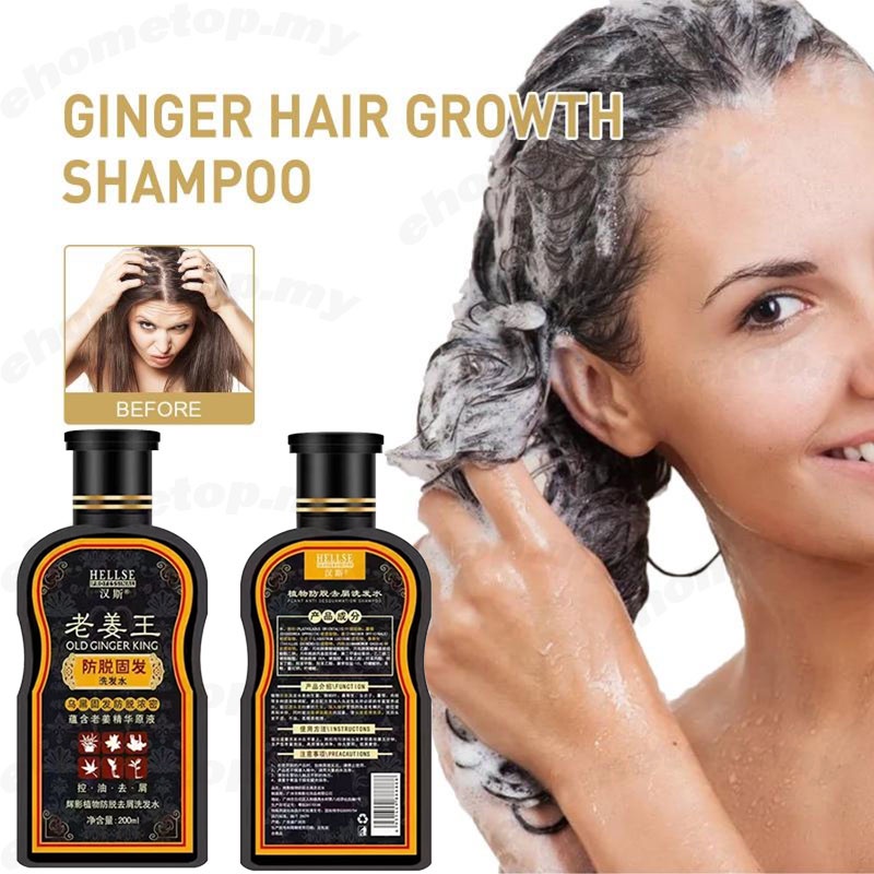 Ready Stock ) Ginger Juice Hair Growth Shampoo Prevent hair loss Strong Hair  Roots hair growth Shampoo 200ml, Dense Hair Shampoo for Man & Woman, Hair  Scalp Treatment Oily Hair Control Repairing