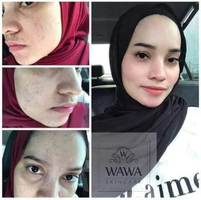 wawa skincare original
