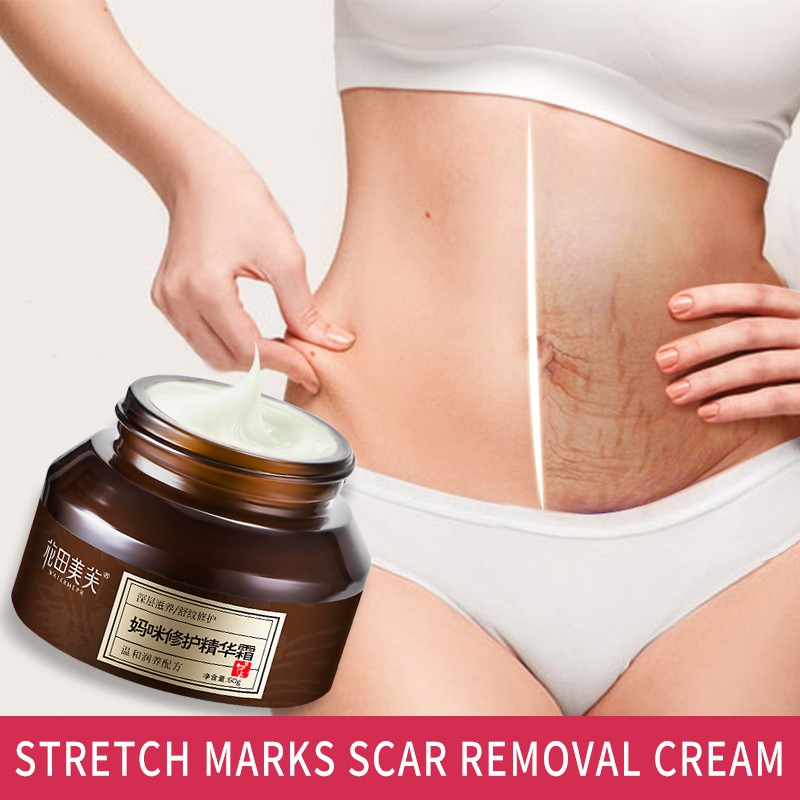 stretch mark and firming cream
