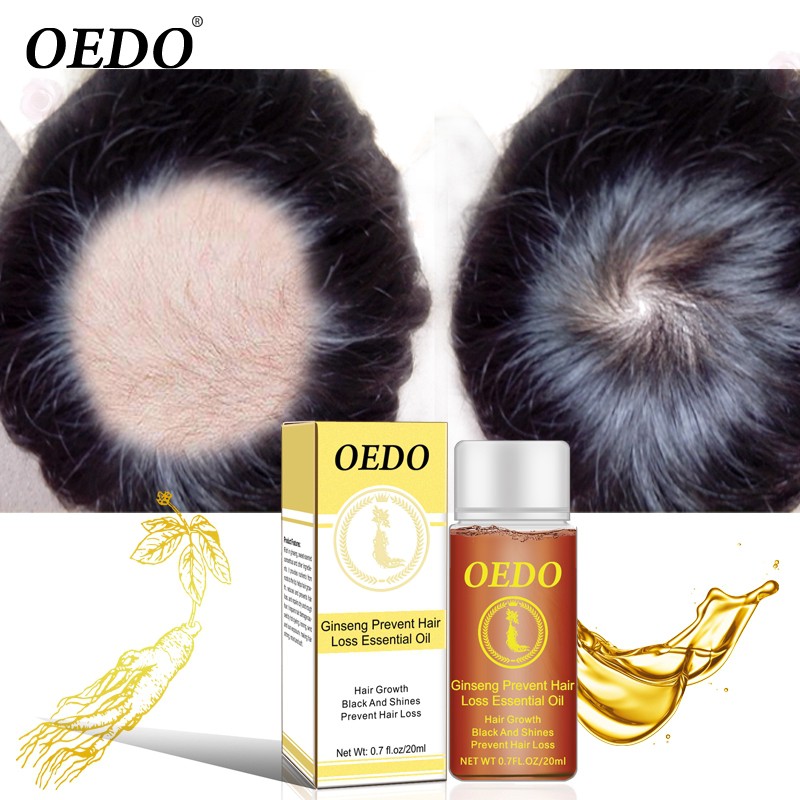 Oedo Ginseng Prevent Hair Loss Essential Oil Hair Growth Black And