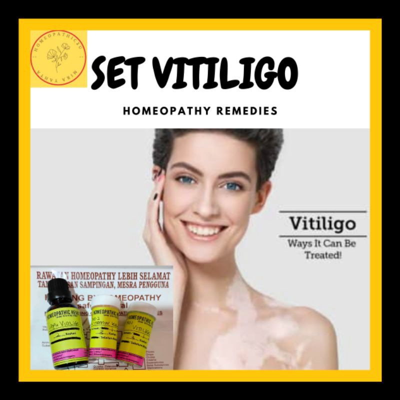 SET VITILIGO HOMEOPATHY  Shopee Malaysia